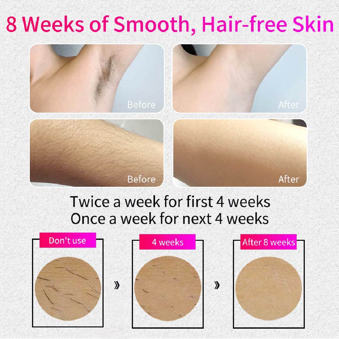 VEME IPL Laser Hair Removal